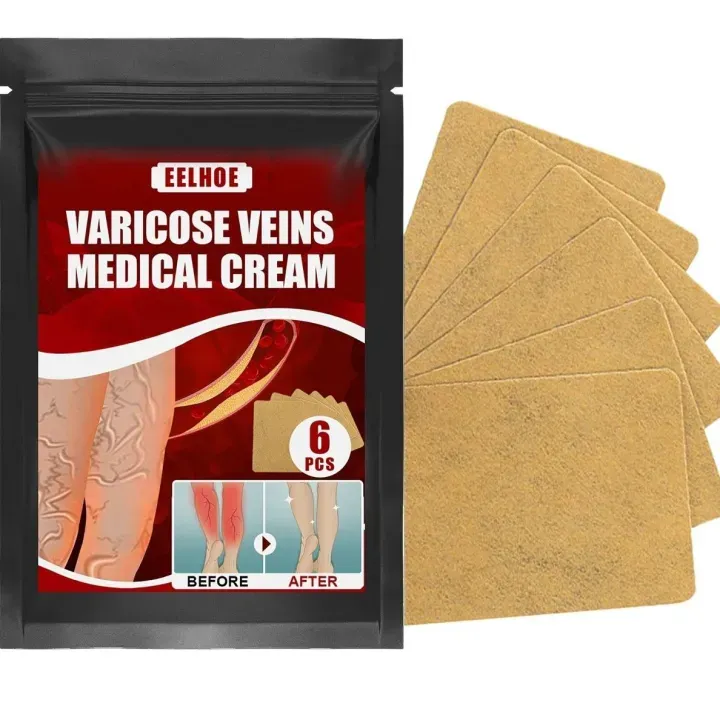 پک چسب 6عددی درمانی واریس پا اورجینال برند eelohe